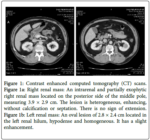 diagnostic-pathology-computed-tomography