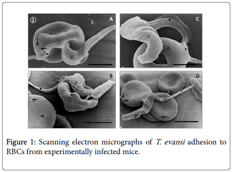 diagnostic-pathology-electron-micrographs