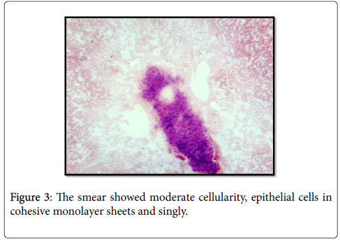 diagnostic-pathology-epithelial-cells