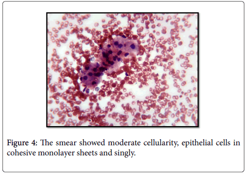 diagnostic-pathology-monolayer-sheets