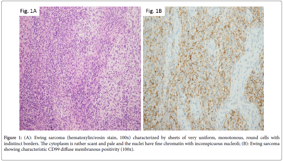 diagnostic-pathology-monotonous-scant