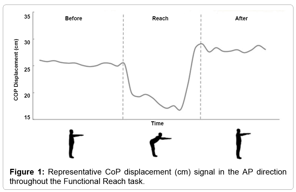 disease-parkinsonism-representative-cop-displacement