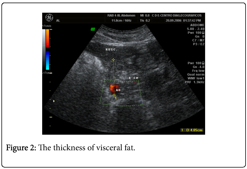 emergencymedicinevisceralfat