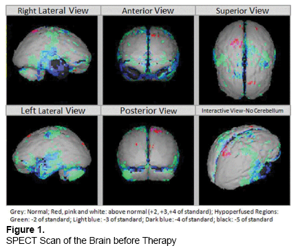 emergency-mental-health-Brain-before-Therapy