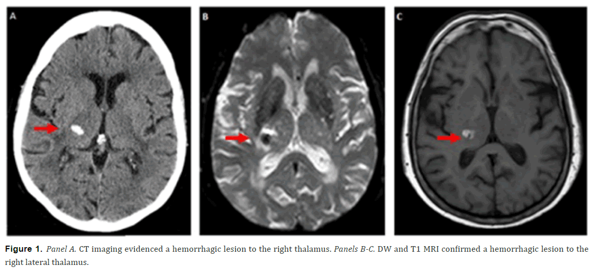 emergency-mental-health-CT-imaging-hemorrhagic-lesion