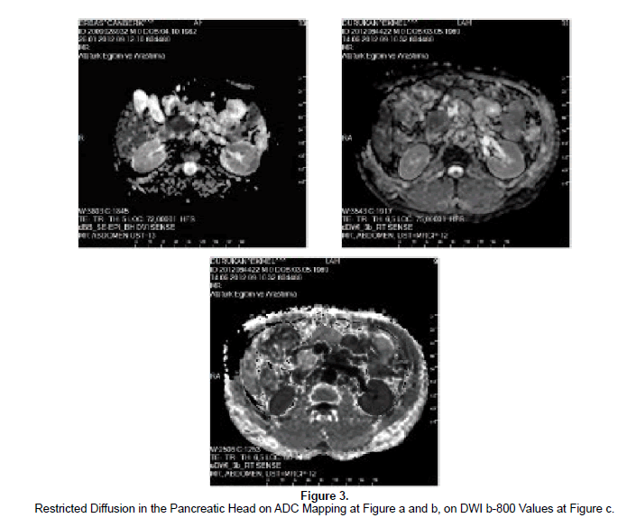 emergency-mental-health-Restricted-Diffusion-Pancreatic