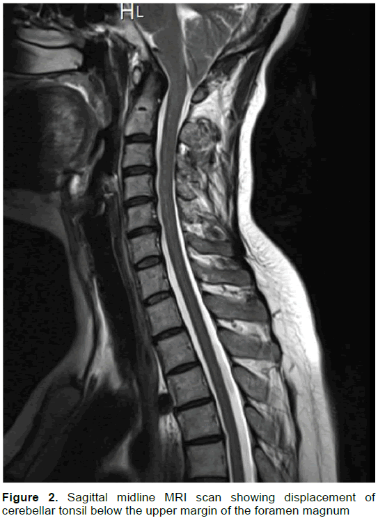 emergency-mental-health-Sagittal-midline