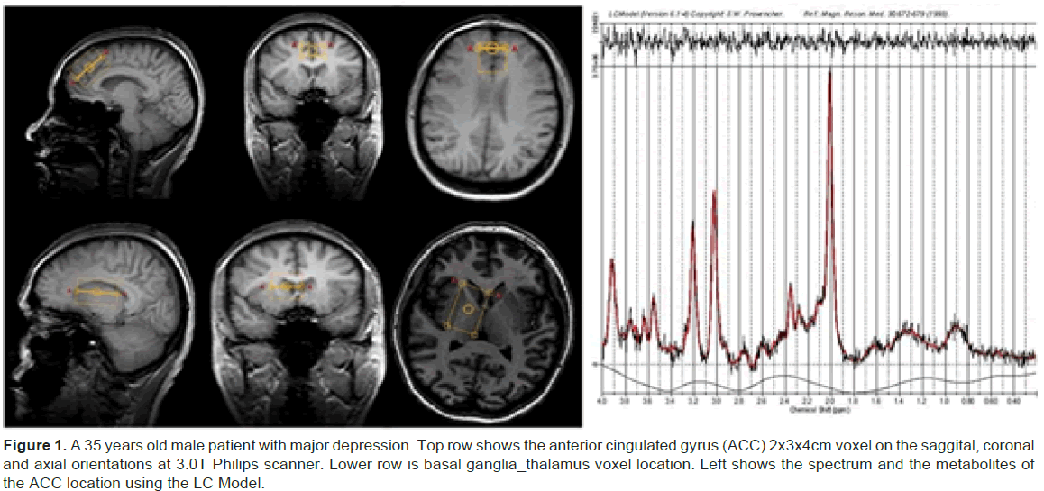 emergency-mental-health-male-patient-with-major-depression