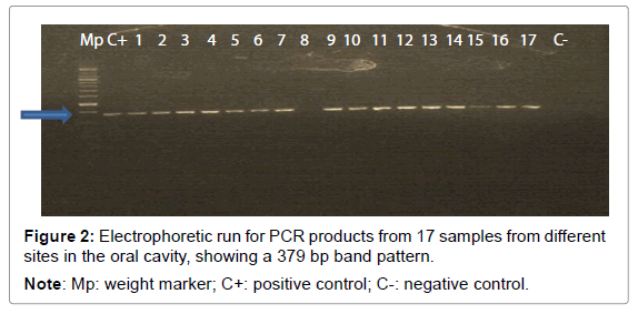 emerging-infectious-diseases-Electrophoretic-run
