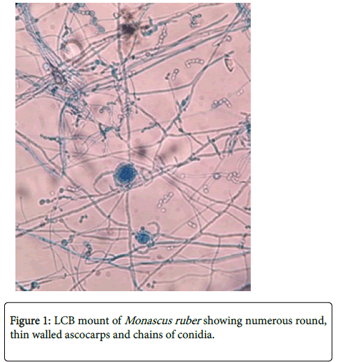 emerging-infectious-diseases-LCB-mount