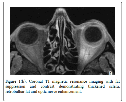 emerging-infectious-diseases-magnetic-resonance