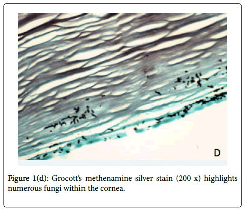emerging-infectious-diseases-numerous-fungi