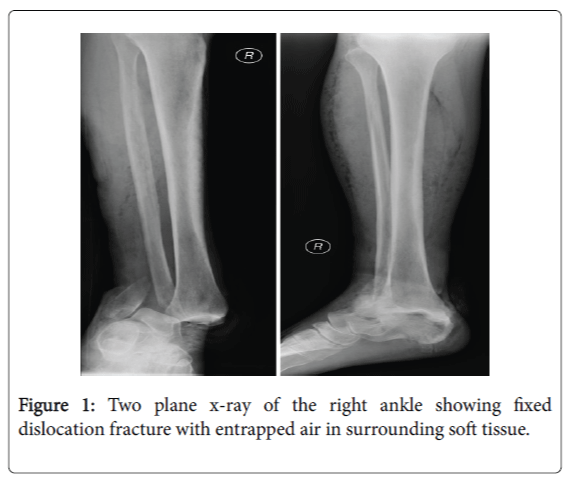 foot-ankle-Two-plane-x-ray