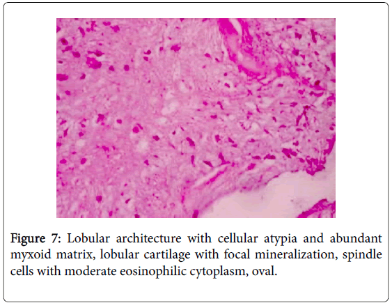 foot-ankle-myxoid-matrix-lobular