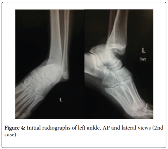 foot-ankle-radiographs-left-ankle