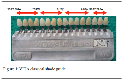Vita Shade Guide Chart
