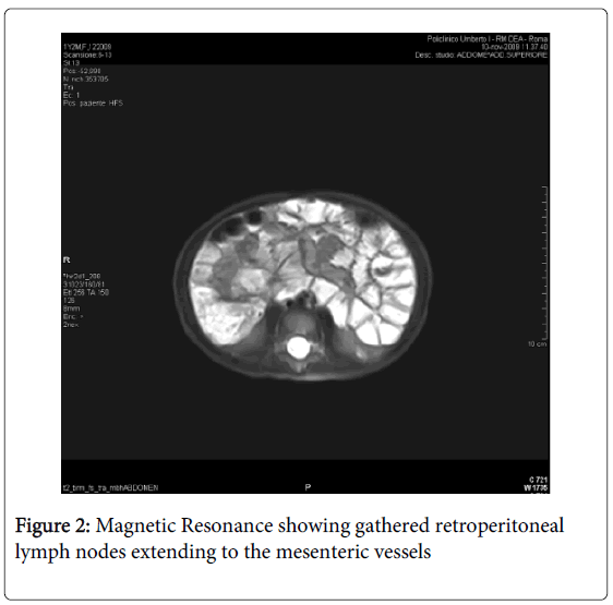 gastrointestinal-Magnetic-Resonance