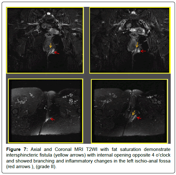 gastrointestinal-digestive-Axial-Coronal-MRI