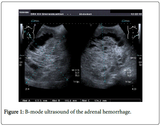 gastrointestinal-digestive-B-mode-ultrasound