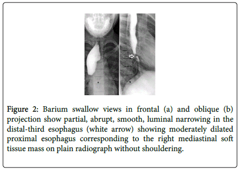 gastrointestinal-digestive-Barium-swallow