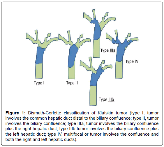 gastrointestinal-digestive-Bismuth-Corlette-classification