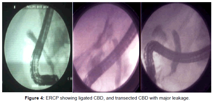 gastrointestinal-digestive-CBD-major-leakage