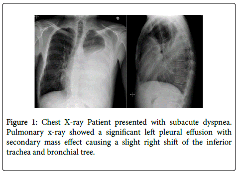 gastrointestinal-digestive-Chest-X-ray