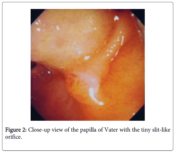 gastrointestinal-digestive-Close-up-view