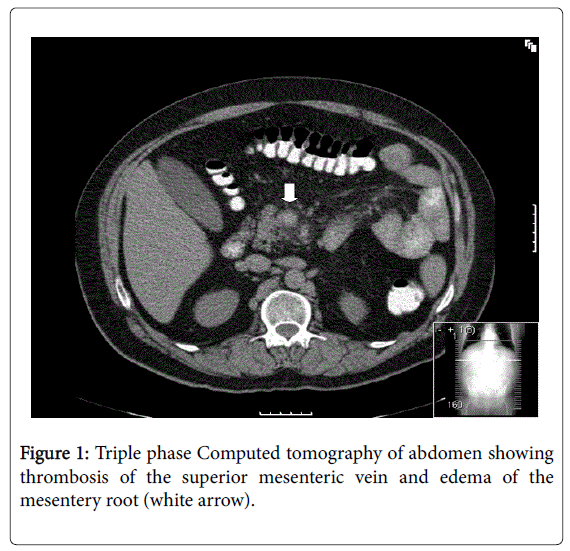 gastrointestinal-digestive-Computed-tomography-abdomen