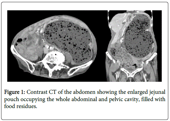 gastrointestinal-digestive-Contrast-CT-abdomen