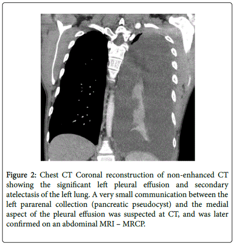 gastrointestinal-digestive-Coronal-reconstruction