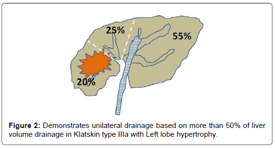 gastrointestinal-digestive-Demonstrates-unilateral-drainage