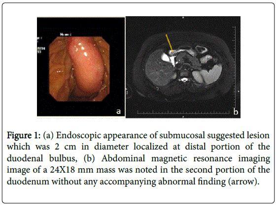 gastrointestinal-digestive-Endoscopic-appearance