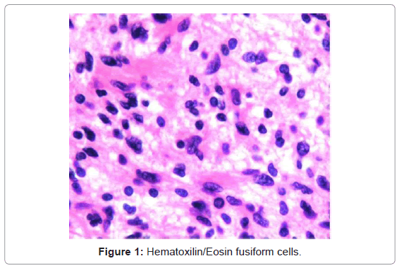 gastrointestinal-digestive-Eosin-fusiform-cells