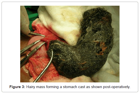gastrointestinal-digestive-Hairy-mass-forming-stomach