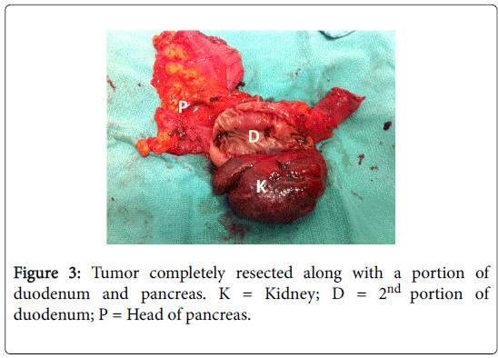 gastrointestinal-digestive-Head-pancreas