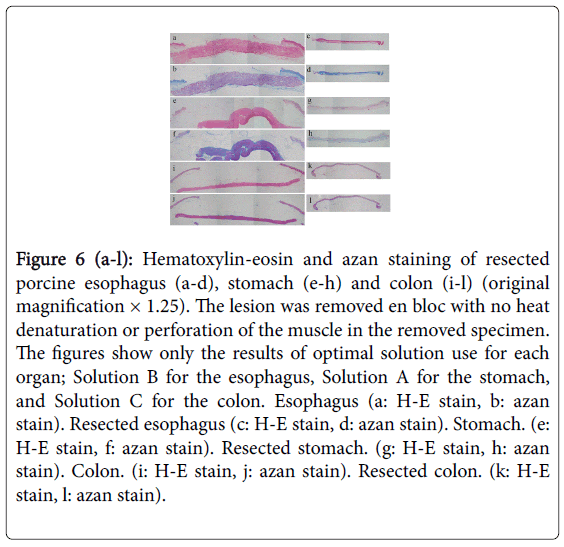 gastrointestinal-digestive-Hematoxylin-eosin-azan