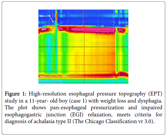 gastrointestinal-digestive-High-resolution-esophageal