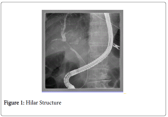 gastrointestinal-digestive-Hilar-Structure
