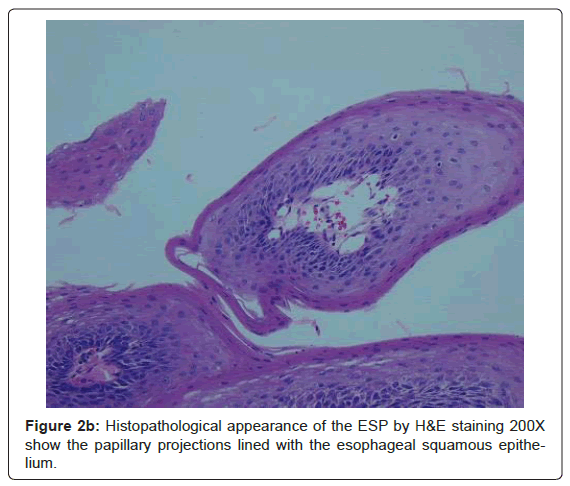 gastrointestinal-digestive-Histopathological-appearance