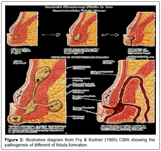 gastrointestinal-digestive-Illustrative-diagram