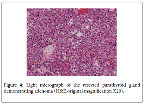 gastrointestinal-digestive-Light-micrograph