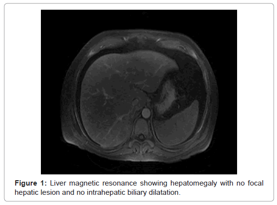 gastrointestinal-digestive-Liver-magnetic-resonance