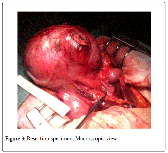 gastrointestinal-digestive-Macroscopic-view