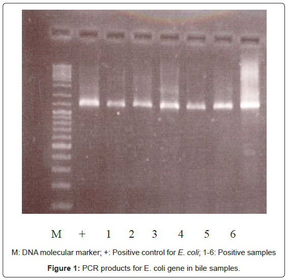 gastrointestinal-digestive-PCR-products-E-coli