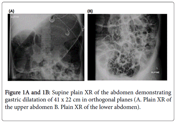 gastrointestinal-digestive-Plain-XR-lower-abdomen