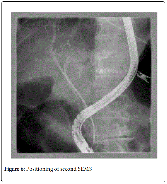 gastrointestinal-digestive-Positioning-second-SEMS