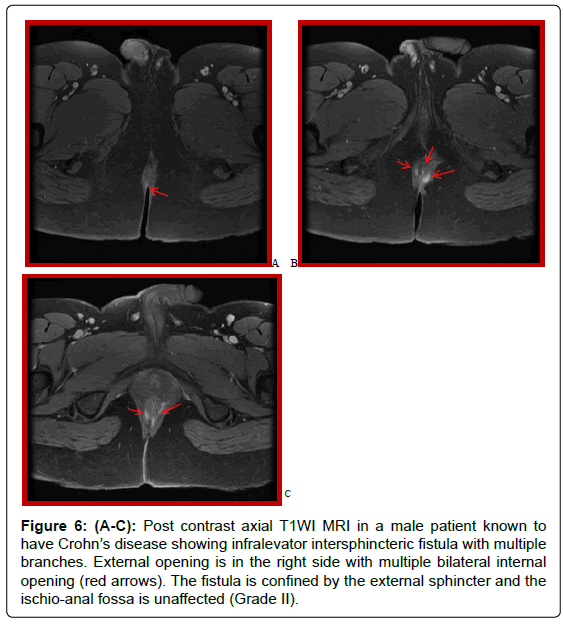 gastrointestinal-digestive-Post-contrast-axial