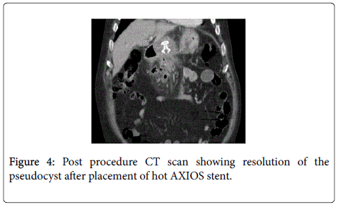gastrointestinal-digestive-Post-procedure
