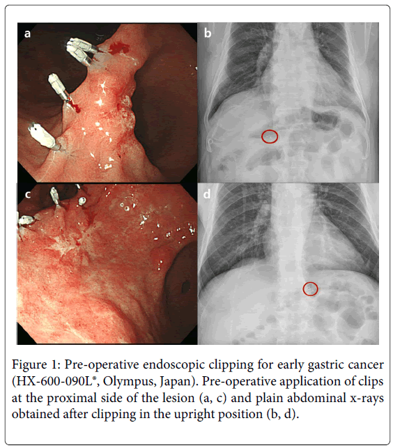 gastrointestinal-digestive-Pre-operative-endoscopic